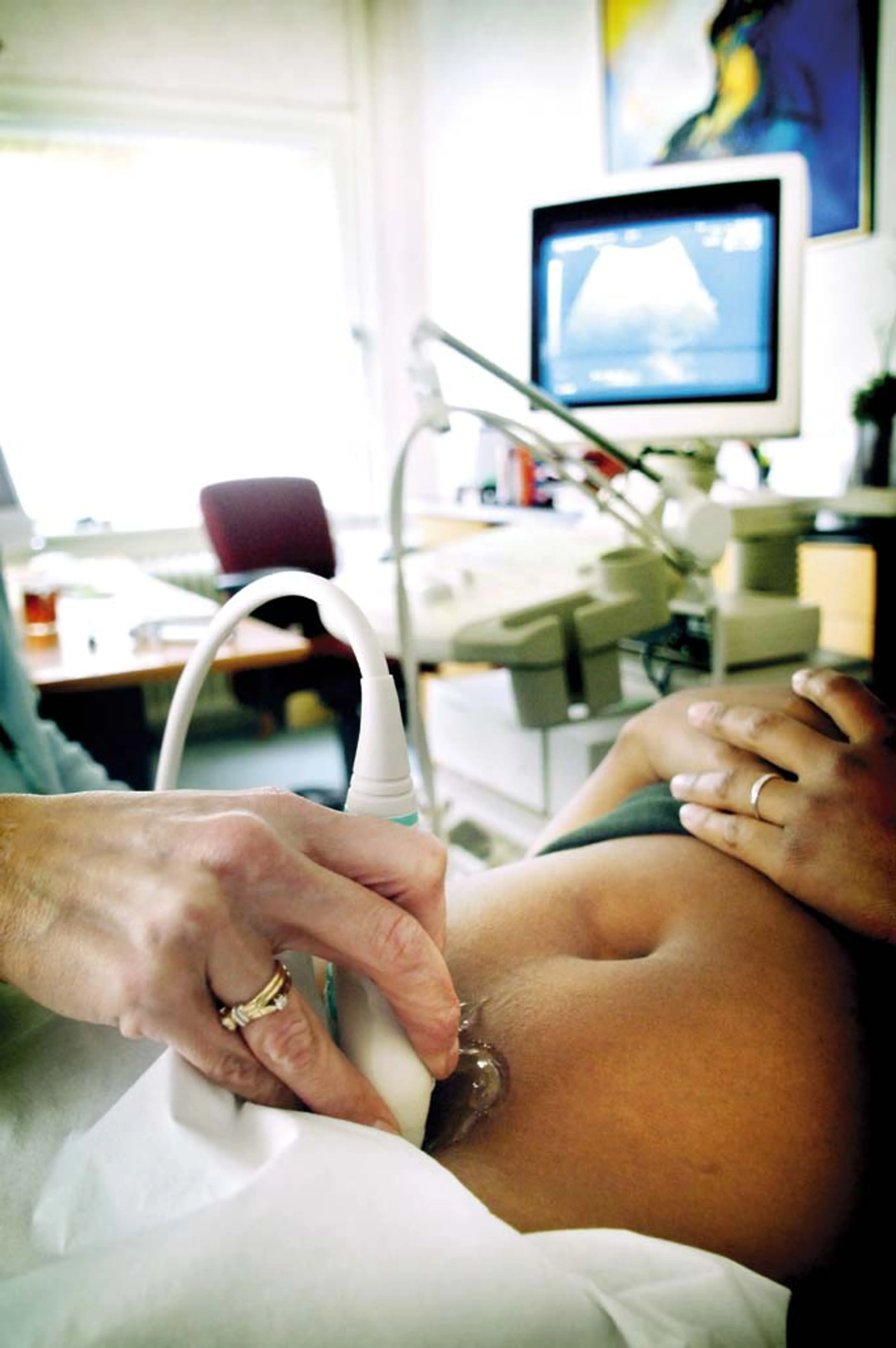 Uitgelichte afbeelding