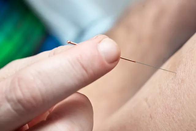 Jennie verbeek vertelt over een positief alternatief voor acupunctuur.