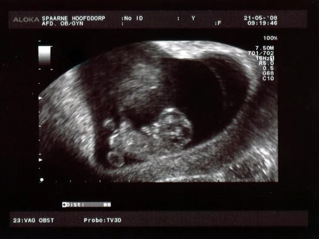 Uitgelichte afbeelding